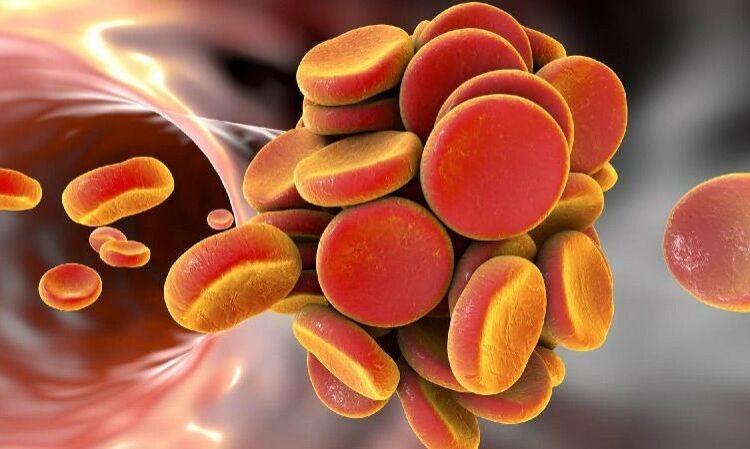 5 Diseases That May Affect Your Platelet Count